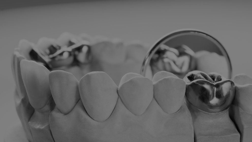 PRÓTESIS DENTALES en Barcelona - Clínica Dental CDZ